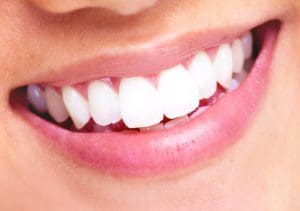 dental bridge photo murfreesboro family dentistry