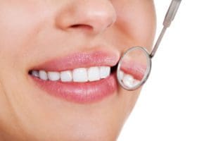 how to whiten teeth fast