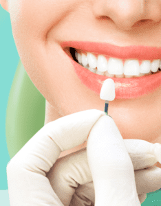 Image of teeth for Murfreesboro Family Dentistry