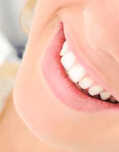 Image of a smile for Murfreesboro Family Dentistry