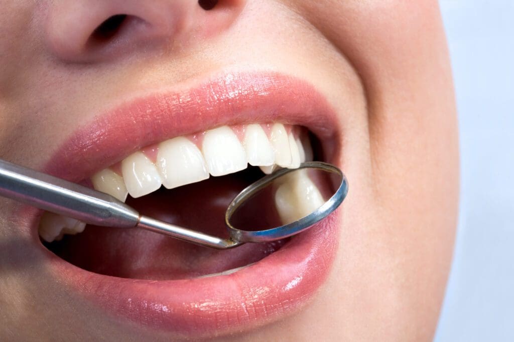 dentist looking in patient's mouth with mirror